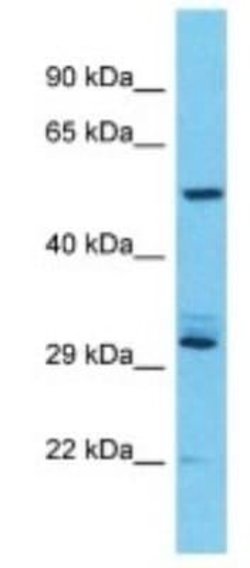 USP17L7 Rabbit anti-Human, Polyclonal, Novus Biologicals 100 &mu;g; Unconjugated:Antibodies,